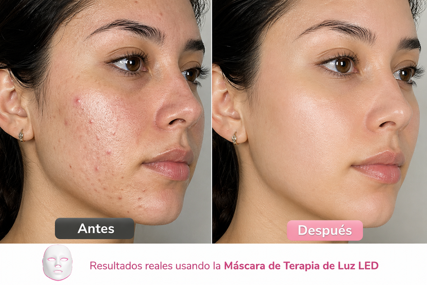 Máscara de Terapia LED 7 Colores — Rejuvenece tu Piel en Casa