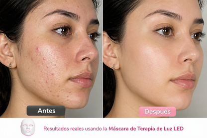 Máscara de Terapia LED 7 Colores — Rejuvenece tu Piel en Casa